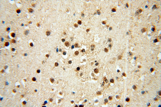 KLF13 Antibody in Immunohistochemistry (Paraffin) (IHC (P))