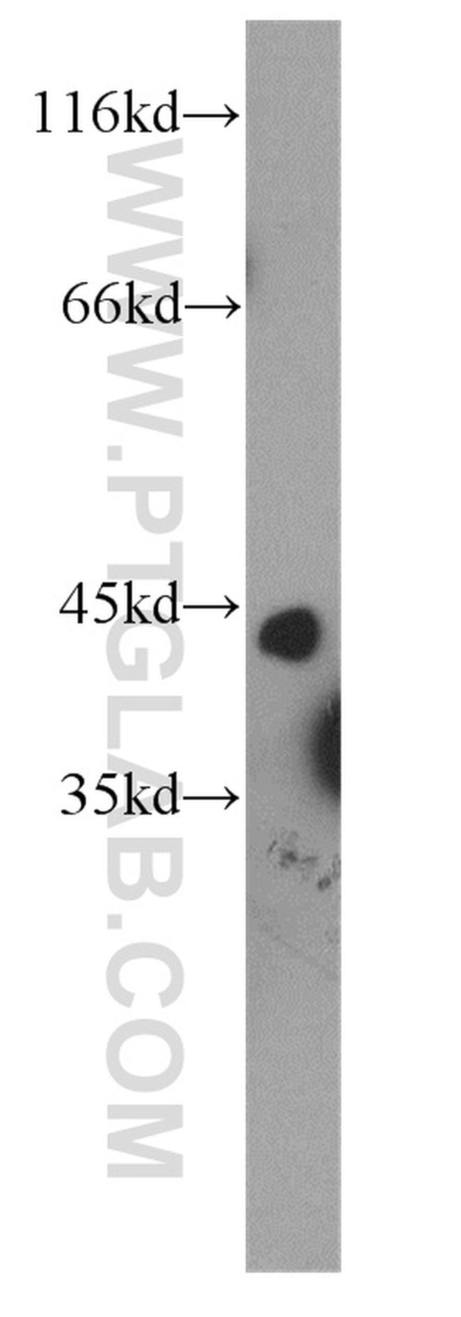 KLF13 Antibody in Western Blot (WB)