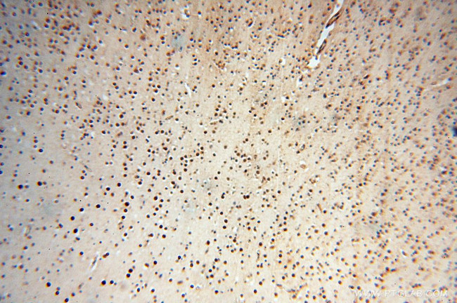 KLF13 Antibody in Immunohistochemistry (Paraffin) (IHC (P))