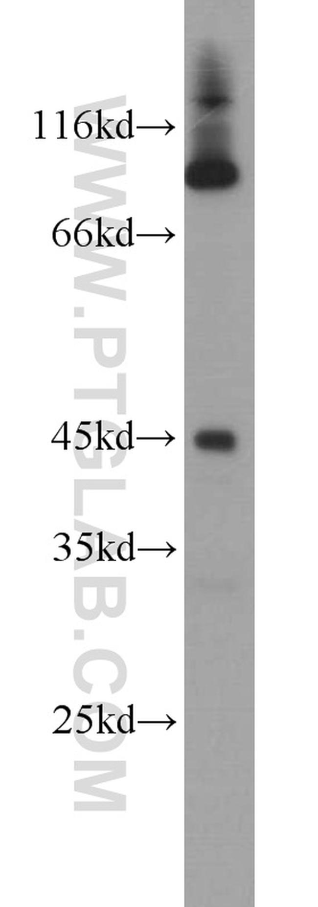 KLF13 Antibody in Western Blot (WB)