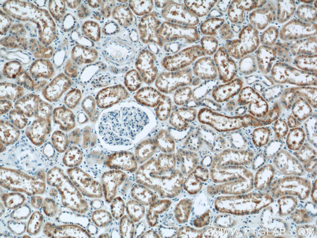 HNRNPL Antibody in Immunohistochemistry (Paraffin) (IHC (P))