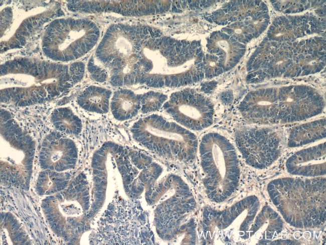 HNRNPL Antibody in Immunohistochemistry (Paraffin) (IHC (P))