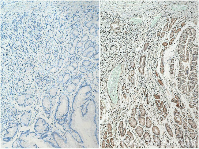 HNRNPL Antibody in Immunohistochemistry (Paraffin) (IHC (P))