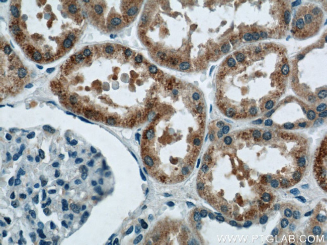 HNRNPL Antibody in Immunohistochemistry (Paraffin) (IHC (P))