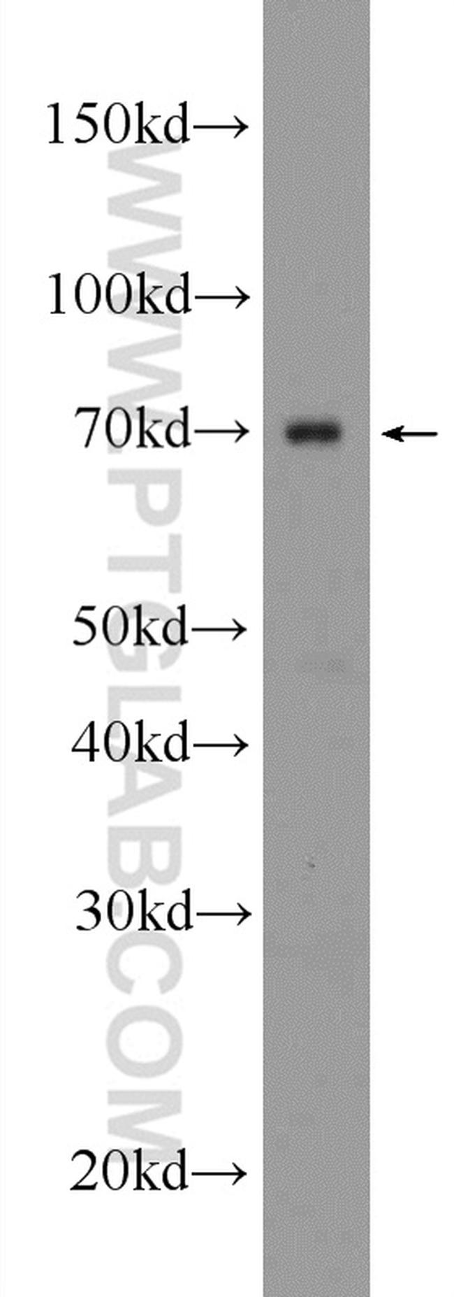 HNRNPL Antibody in Western Blot (WB)