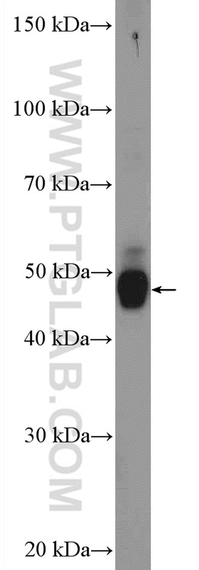 Orexin receptor 1 Antibody in Western Blot (WB)