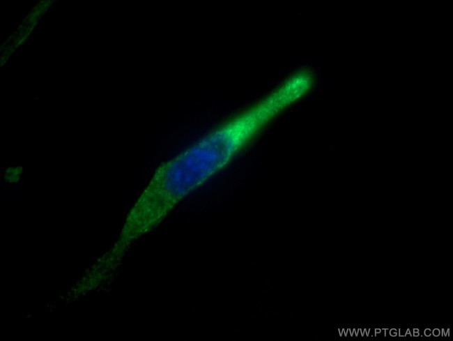 ANGPTL4 Antibody in Immunocytochemistry (ICC/IF)