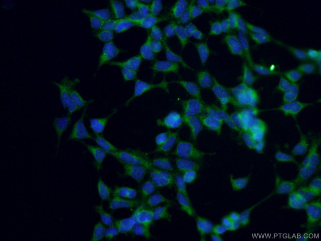 ANGPTL4 Antibody in Immunocytochemistry (ICC/IF)