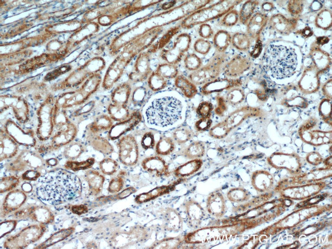 ANGPTL4 Antibody in Immunohistochemistry (Paraffin) (IHC (P))