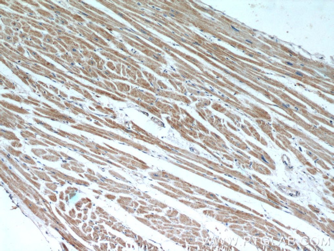 ANGPTL4 Antibody in Immunohistochemistry (Paraffin) (IHC (P))