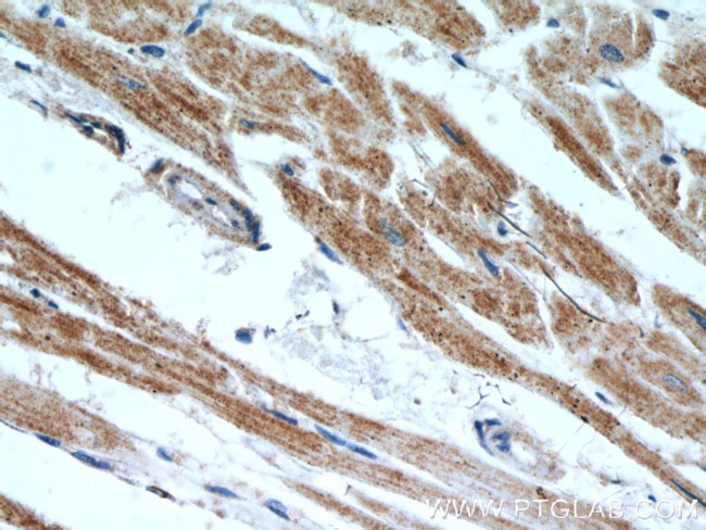 ANGPTL4 Antibody in Immunohistochemistry (Paraffin) (IHC (P))