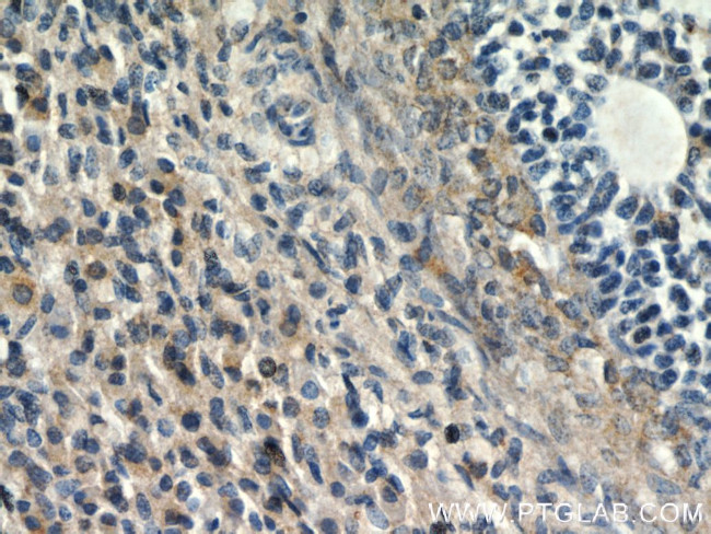 ANGPTL4 Antibody in Immunohistochemistry (Paraffin) (IHC (P))