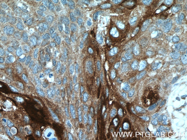 ANGPTL4 Antibody in Immunohistochemistry (Paraffin) (IHC (P))