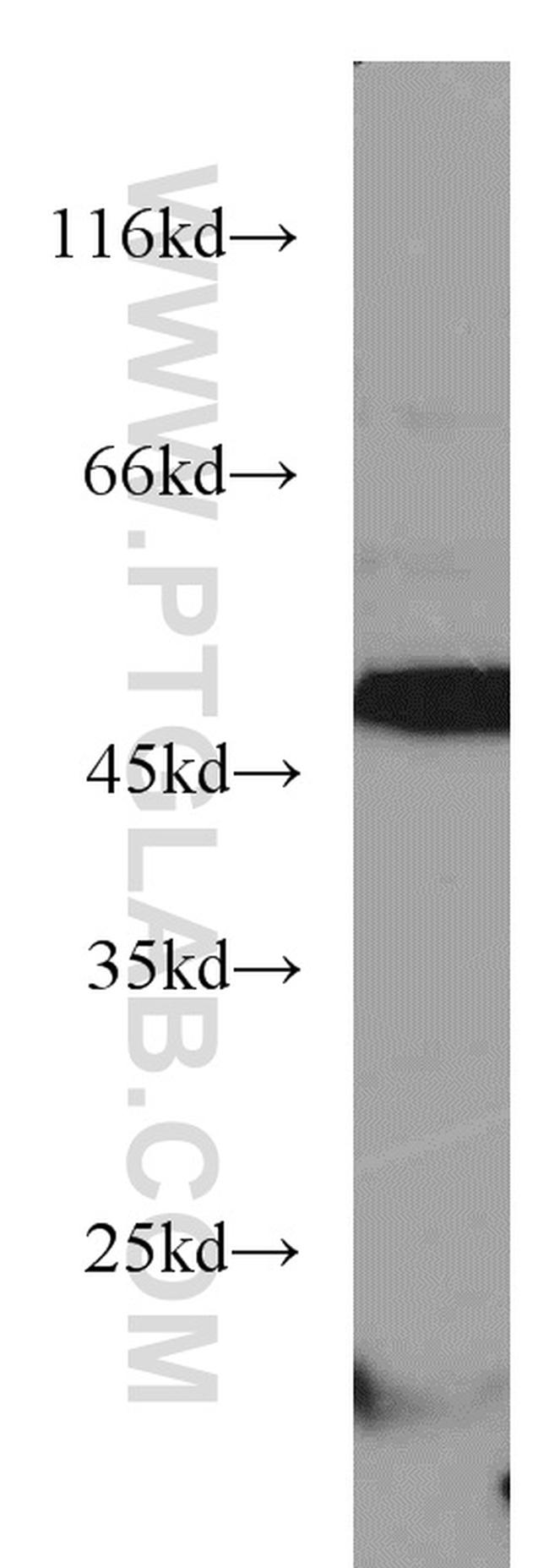 ANGPTL4 Antibody in Western Blot (WB)