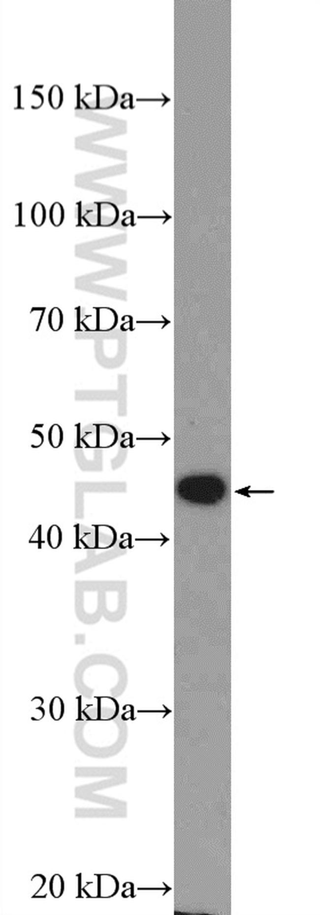 ANGPTL4 Antibody in Western Blot (WB)