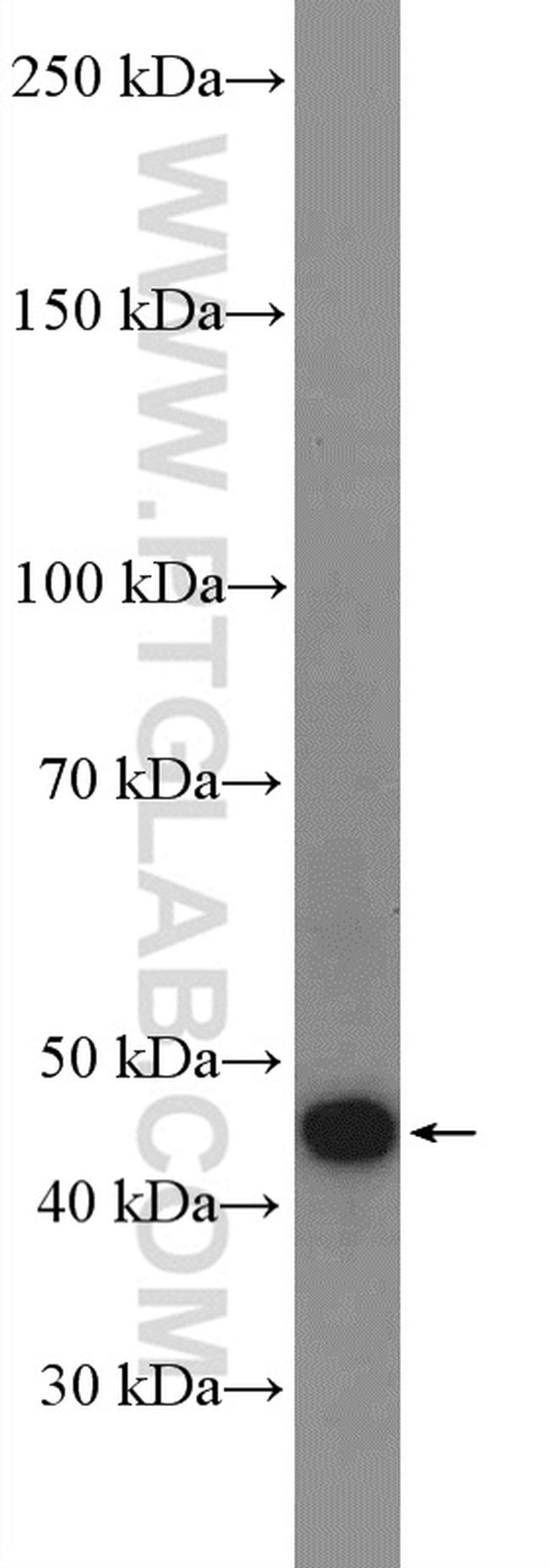 ANGPTL4 Antibody in Western Blot (WB)