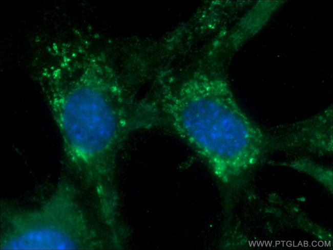 KISS1 Antibody in Immunocytochemistry (ICC/IF)