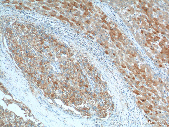 KISS1 Antibody in Immunohistochemistry (Paraffin) (IHC (P))