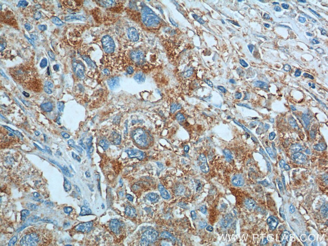 KISS1 Antibody in Immunohistochemistry (Paraffin) (IHC (P))