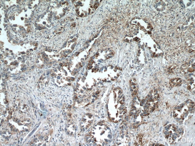 KISS1 Antibody in Immunohistochemistry (Paraffin) (IHC (P))