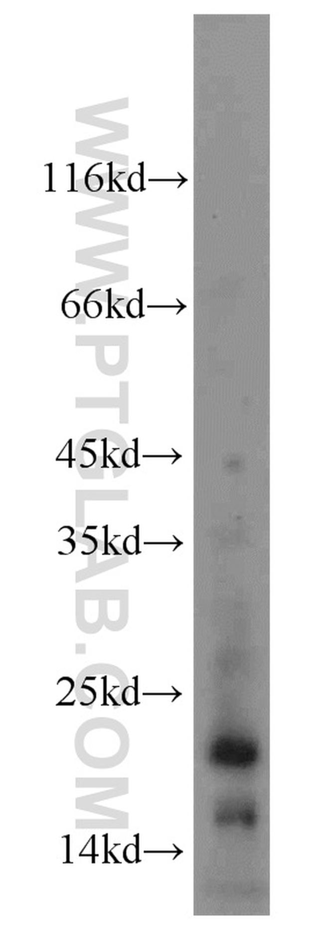 KISS1 Antibody in Western Blot (WB)