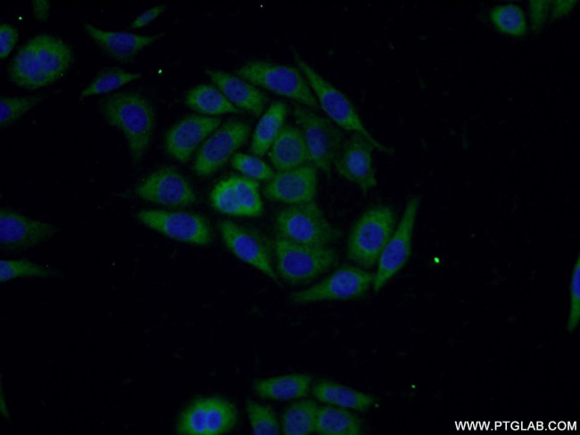 SLN Antibody in Immunocytochemistry (ICC/IF)