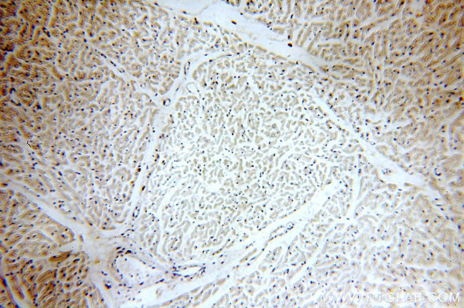 SLN Antibody in Immunohistochemistry (Paraffin) (IHC (P))