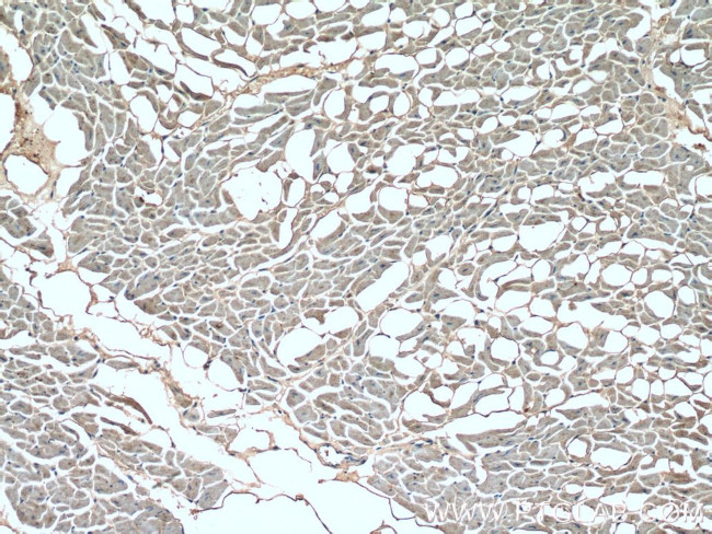 SLN Antibody in Immunohistochemistry (Paraffin) (IHC (P))