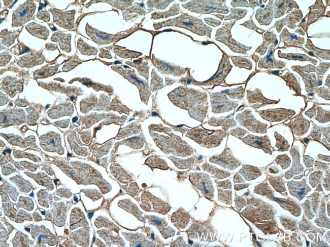 SLN Antibody in Immunohistochemistry (Paraffin) (IHC (P))