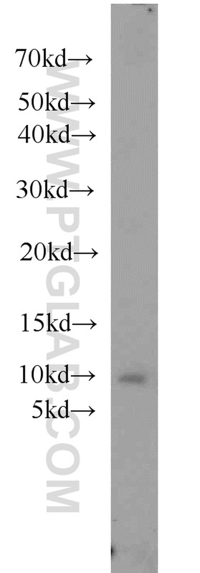 SLN Antibody in Western Blot (WB)