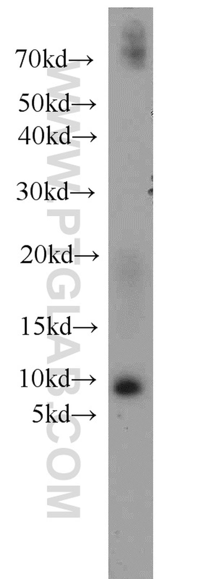 SLN Antibody in Western Blot (WB)