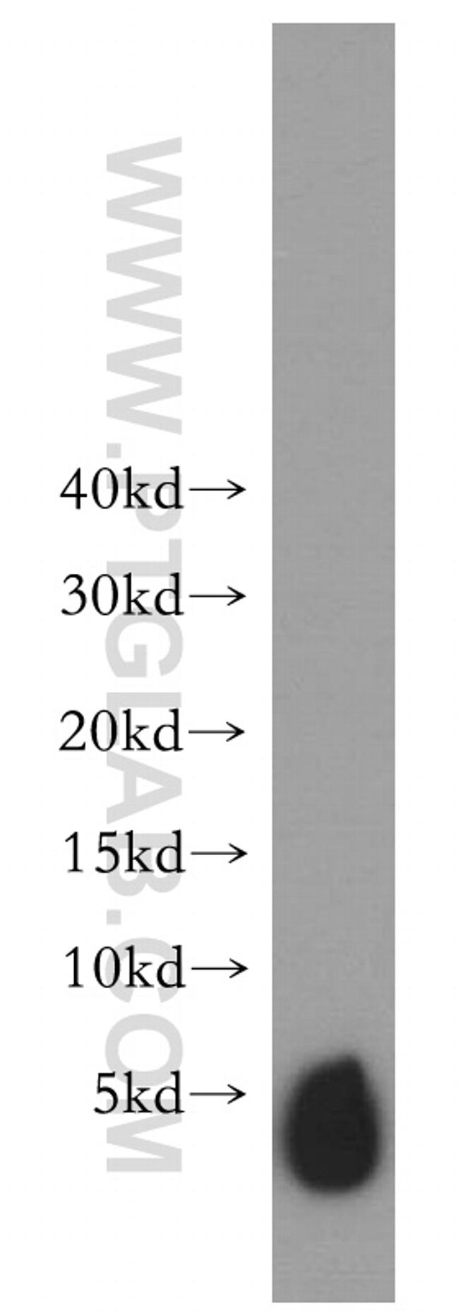 SLN Antibody in Western Blot (WB)