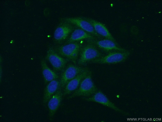 PSAP Antibody in Immunocytochemistry (ICC/IF)