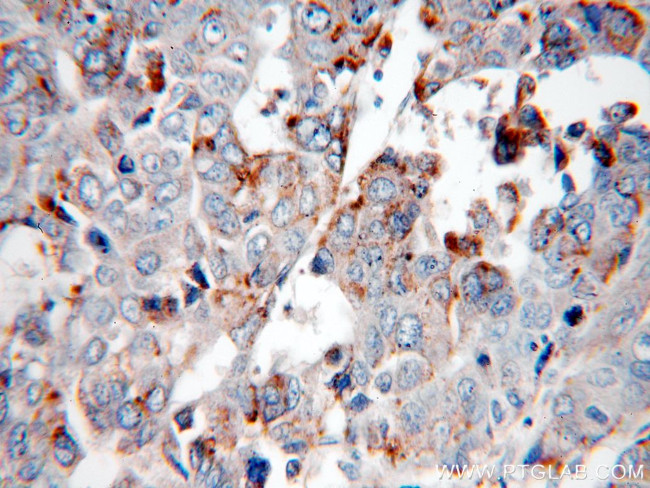 PSAP Antibody in Immunohistochemistry (Paraffin) (IHC (P))