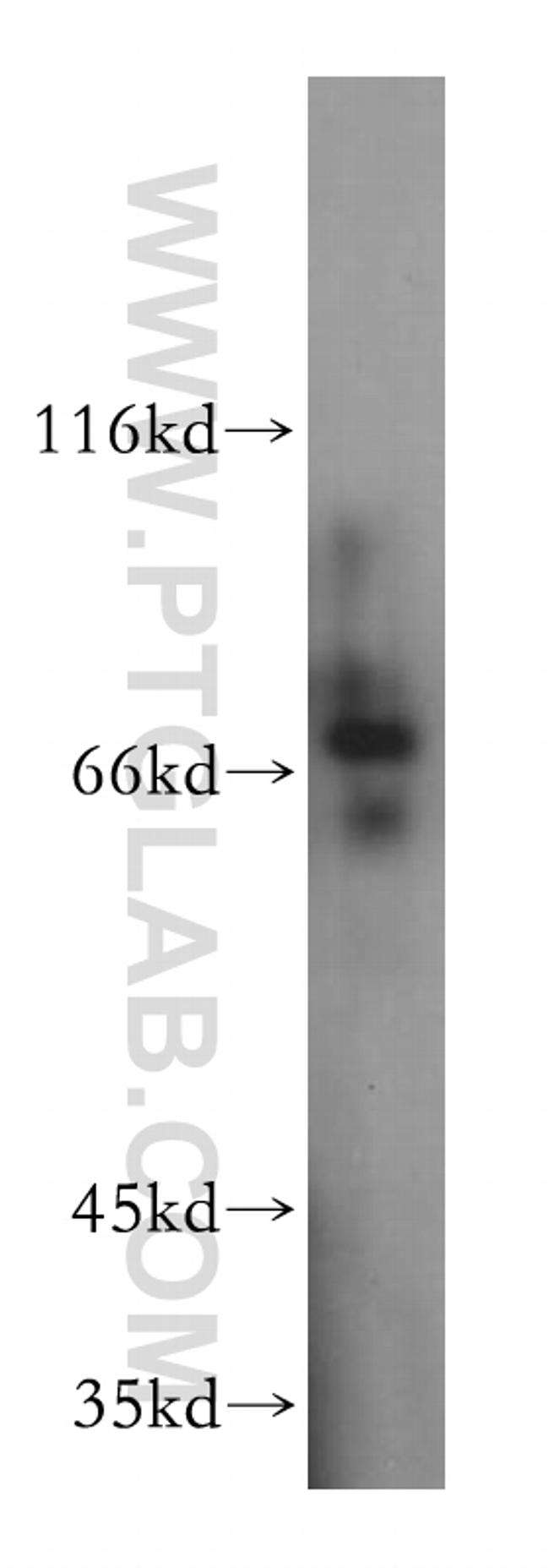 PSAP Antibody in Western Blot (WB)