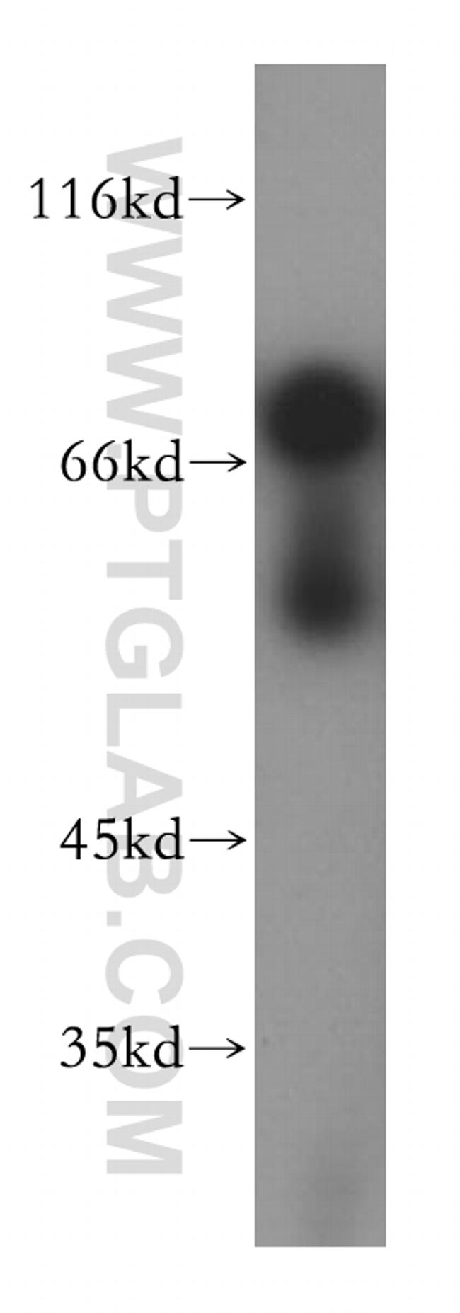 PSAP Antibody in Western Blot (WB)