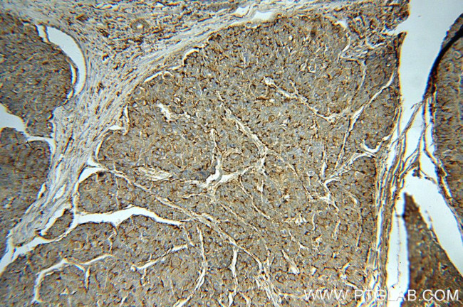 PSAP Antibody in Immunohistochemistry (Paraffin) (IHC (P))