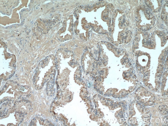 PSAP Antibody in Immunohistochemistry (Paraffin) (IHC (P))