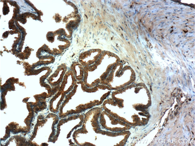 PSAP Antibody in Immunohistochemistry (Paraffin) (IHC (P))