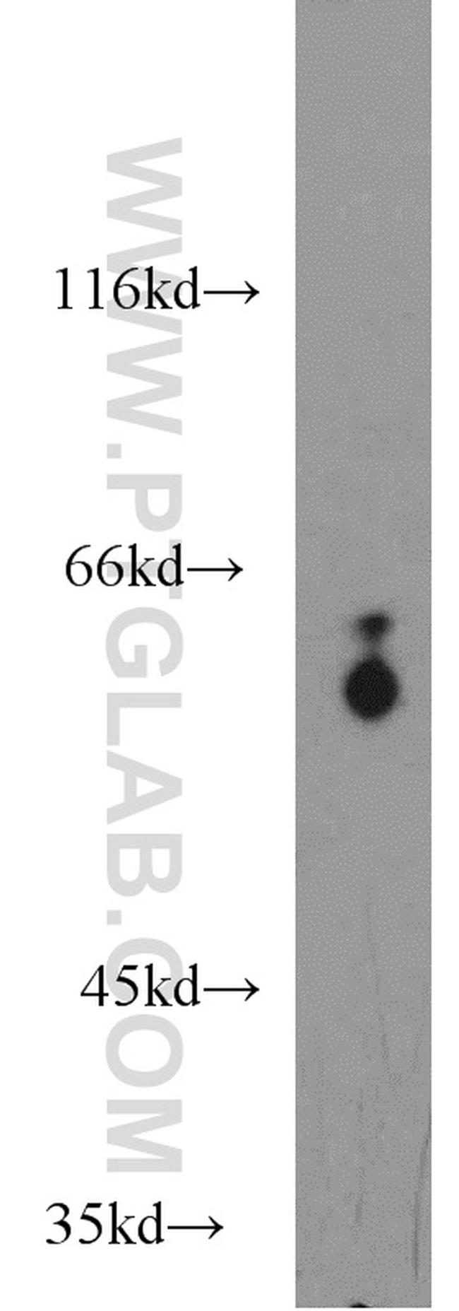 PSAP Antibody in Western Blot (WB)