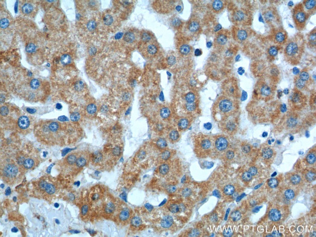 TOMM40 Antibody in Immunohistochemistry (Paraffin) (IHC (P))