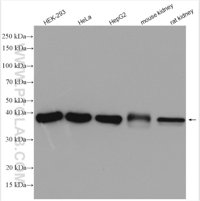 TOMM40 Antibody in Western Blot (WB)