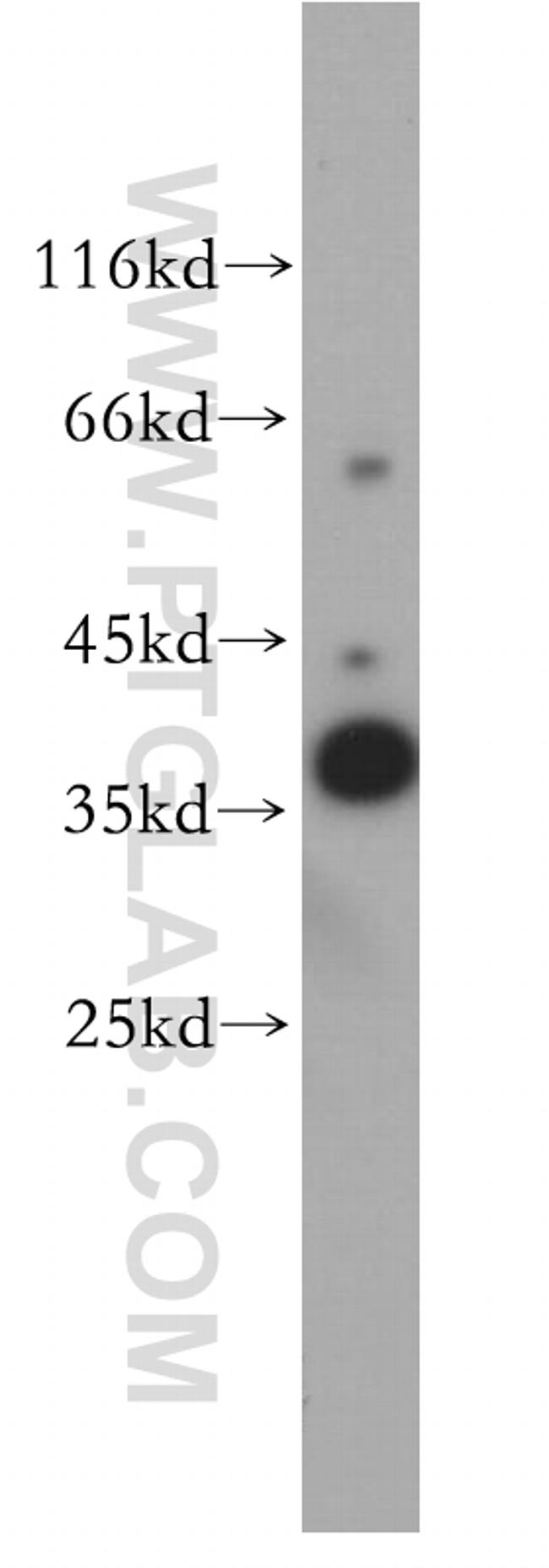 TOMM40 Antibody in Western Blot (WB)