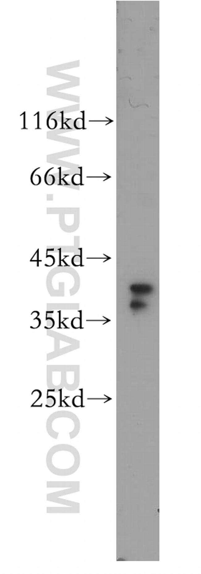 TOMM40 Antibody in Western Blot (WB)