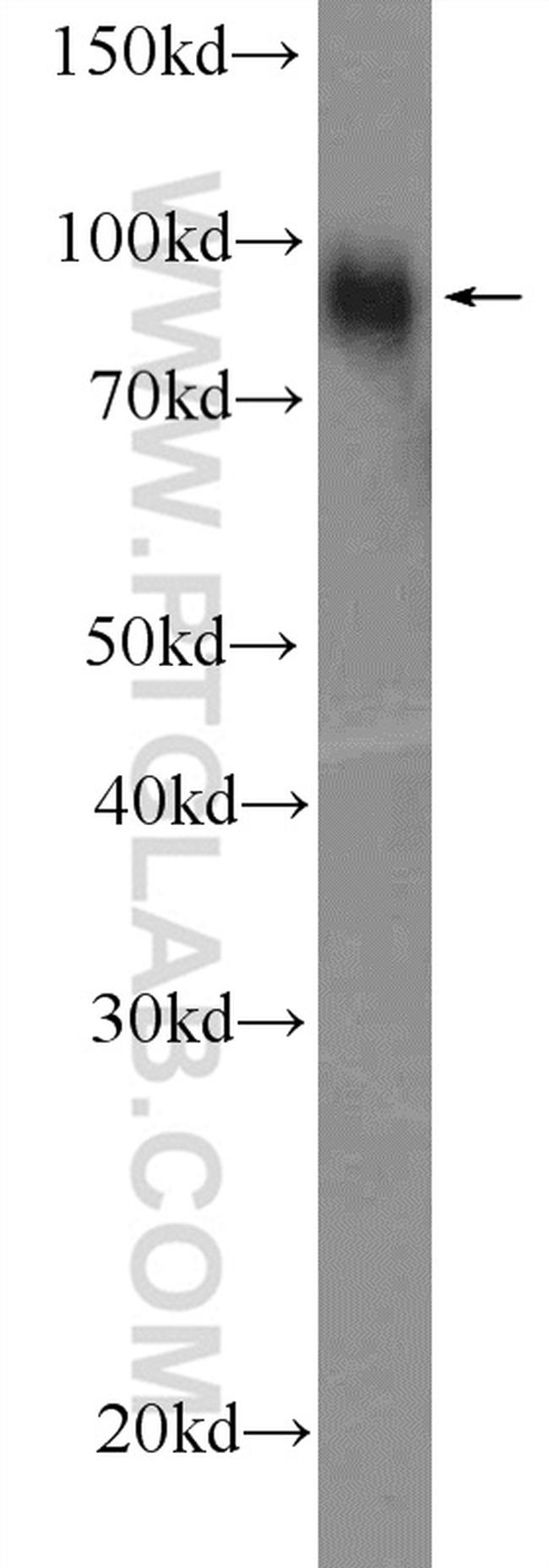 FURIN Antibody in Western Blot (WB)