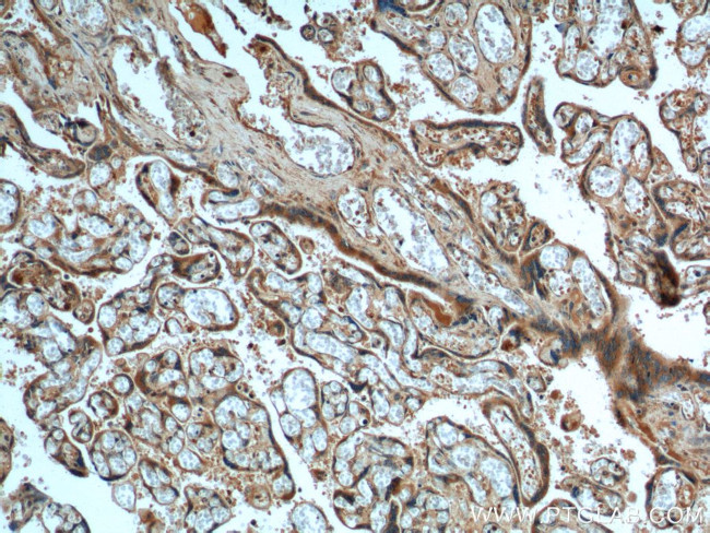 FURIN Antibody in Immunohistochemistry (Paraffin) (IHC (P))