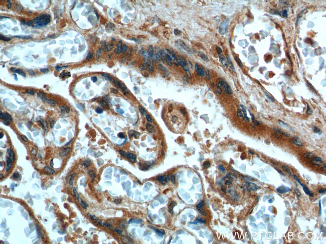 FURIN Antibody in Immunohistochemistry (Paraffin) (IHC (P))