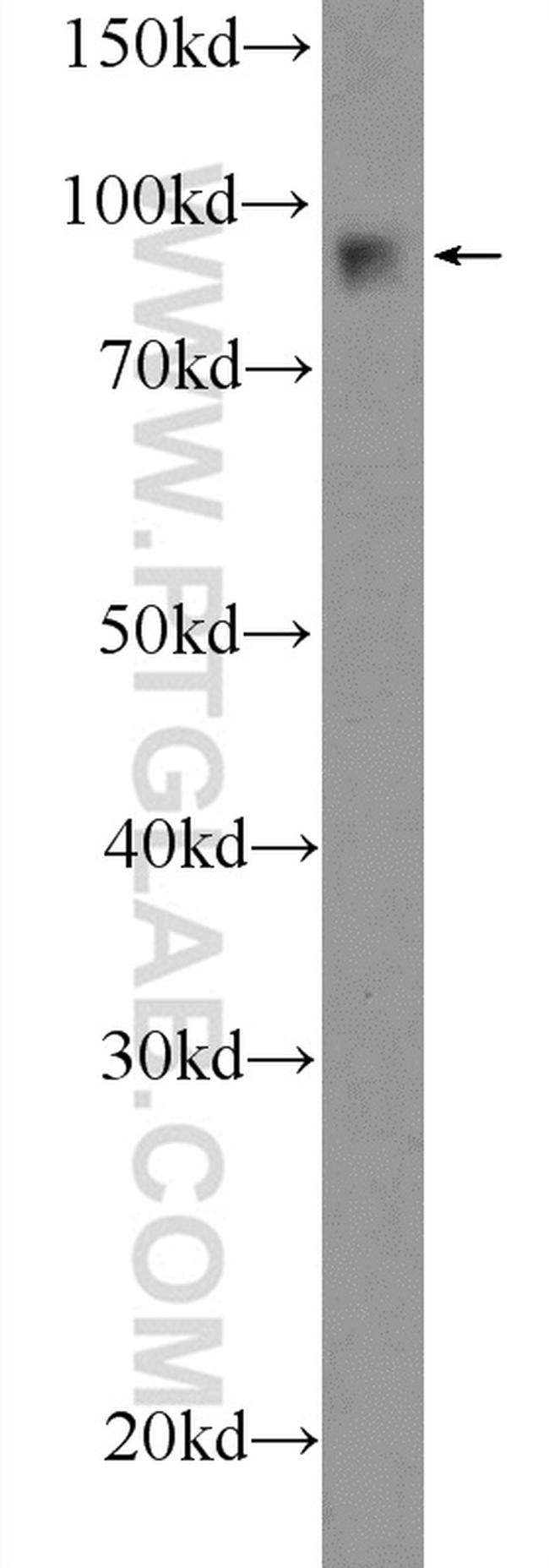 FURIN Antibody in Western Blot (WB)