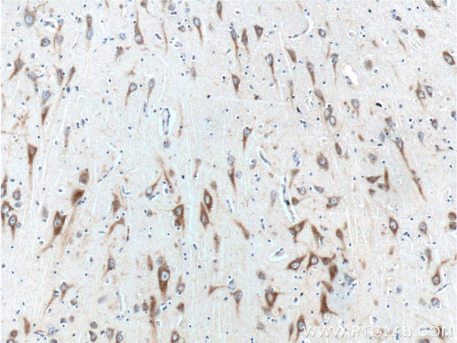 RXFP1 Antibody in Immunohistochemistry (Paraffin) (IHC (P))