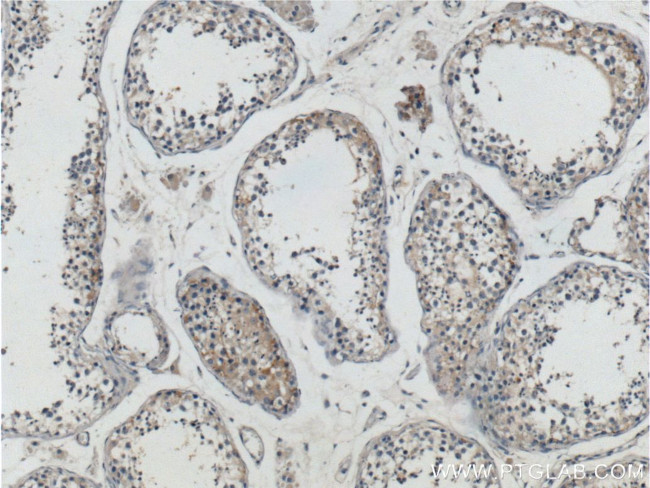 RXFP1 Antibody in Immunohistochemistry (Paraffin) (IHC (P))